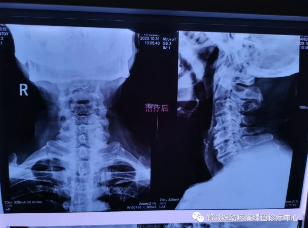 外星艙治療后 外星艙治療后