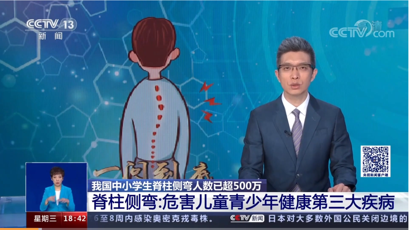 青少年脊柱側(cè)彎現(xiàn)狀堪憂 青少年脊柱側(cè)彎現(xiàn)狀堪憂